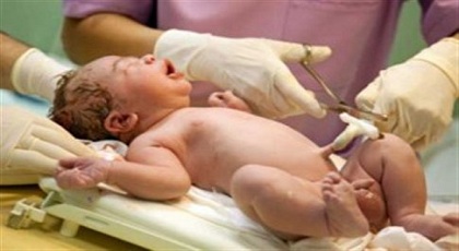 Ο ομφάλιος λώρος του μωρού δεν πρέπει να κόβεται αμέσως μετά τη γέννα