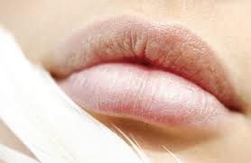 Εύκολα και γρήγορα tips για σκασμένα χείλη