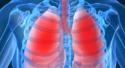 Όλα όσα πρέπει να ξέρετε για την πνευμονία