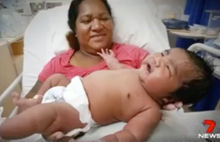 Γέννησε μωρό «γίγας» 6,6 κιλά με φυσιολογικό τοκετό! (φωτό)