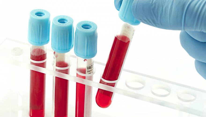 ΗΠΑ: Νέο τεστ αίματος ανιχνεύει που αναπτύσσεται στο σώμα ο καρκίνος