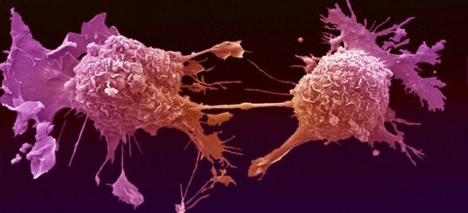 Καινοτόμες τεχνολογίες κατά του καρκίνου