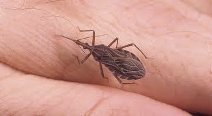 H ασθένεια Chagas