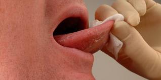 Γιατί και πώς εμφανίζεται ο καρκίνος του στόματος;