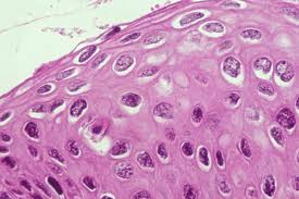 HPV: Οι επιπτώσεις και οι μορφές του ιού
