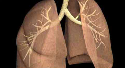 Θερίζει ο καρκίνος του πνεύμονα στην Ελλάδα