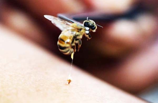 Πρώτες βοήθειες για το τσίμπημα από σκορπιό, σφήκα ή μέλισσα