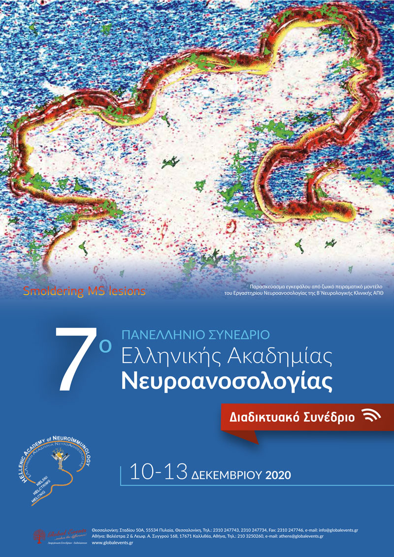 Η σχέση εμβολιασμού για τον κορωνοϊό και πολλαπλής σκλήρυνσης