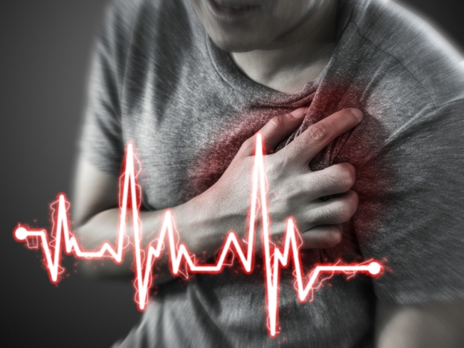 Νεότερα δεδομένα σχετικά με την κολπική μαρμαρυγή και την καρδιακή θρόμβωση σε ασθενείς με COVID-19
