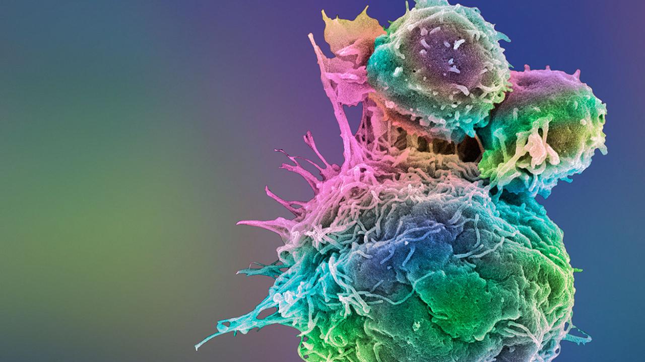 Eξελίξεις για τη μόνιμη ίαση του καρκίνου: Ο στόχος της ανοσοθεραπείας