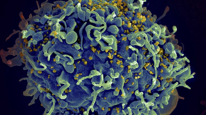 HIV: Γιατί ο ιός δεν μεταδίδεται τόσο εύκολα στα ετεροφιλόφυλα ζευγάρια;