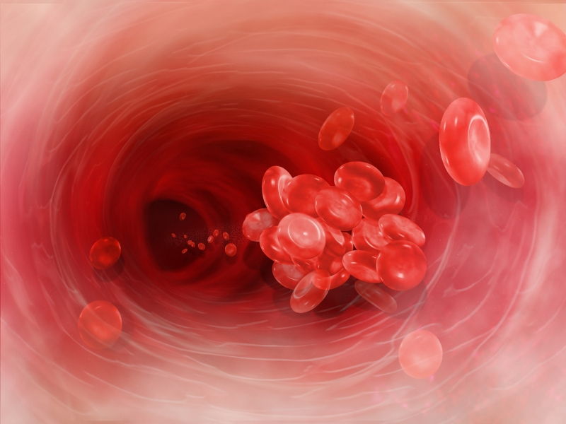 Θρόμβοι αίματος στους ασθενείς με COVID-19: Μπορεί να αποδίδονται στη δράση Αυτοαντισωμάτων;