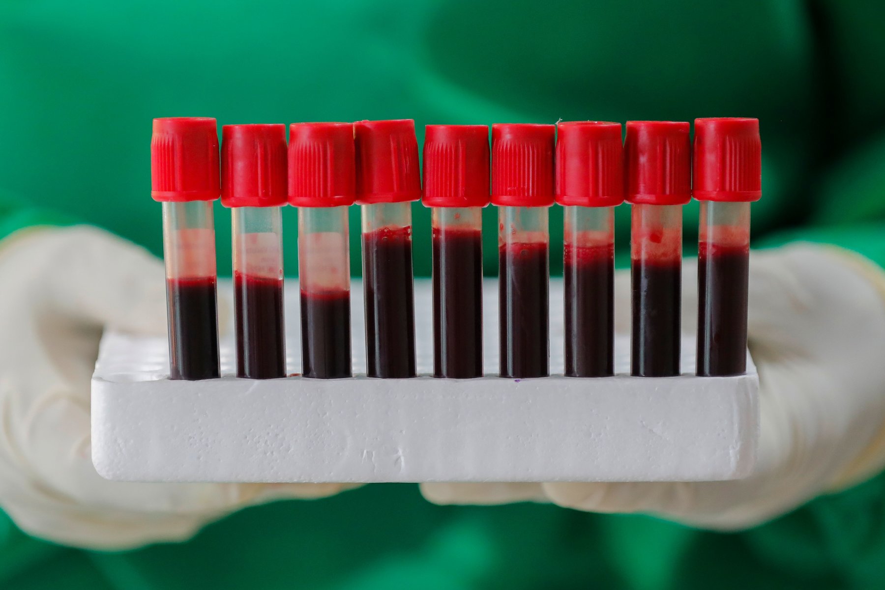 Νέα μελέτη: Η ομάδα αίματος δεν φαίνεται να επηρεάζει την πιθανότητα λοίμωξης (βίντεο)