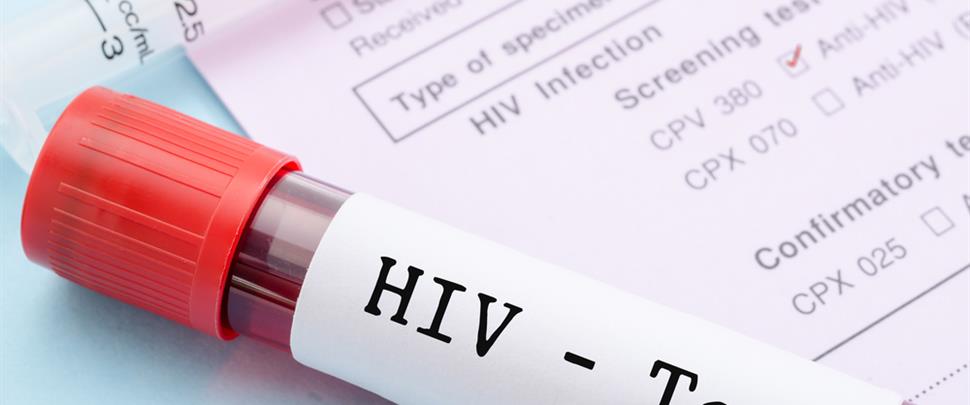 ΕΟΔΥ: Δωρεάν έλεγχοι για τον HIV