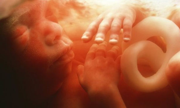 Ενδομήτριος θάνατος εμβρύου και κορωνοϊός – Τέσσερα περιστατικά στη χώρα μας