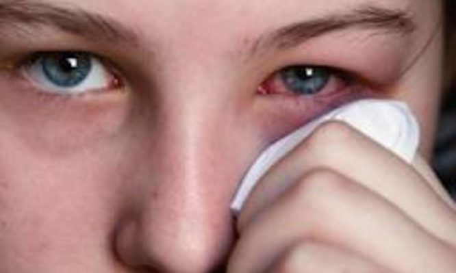 Ξηροφθαλμία – Πόσο μας χρειάζονται τα δάκρυα;