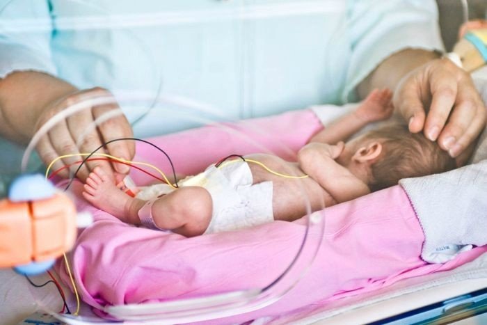 Πρόωρος τοκετός: Ποιους κινδύνους αντιμετωπίζει ένα νεογέννητο σύμφωνα με νεα μελέτη
