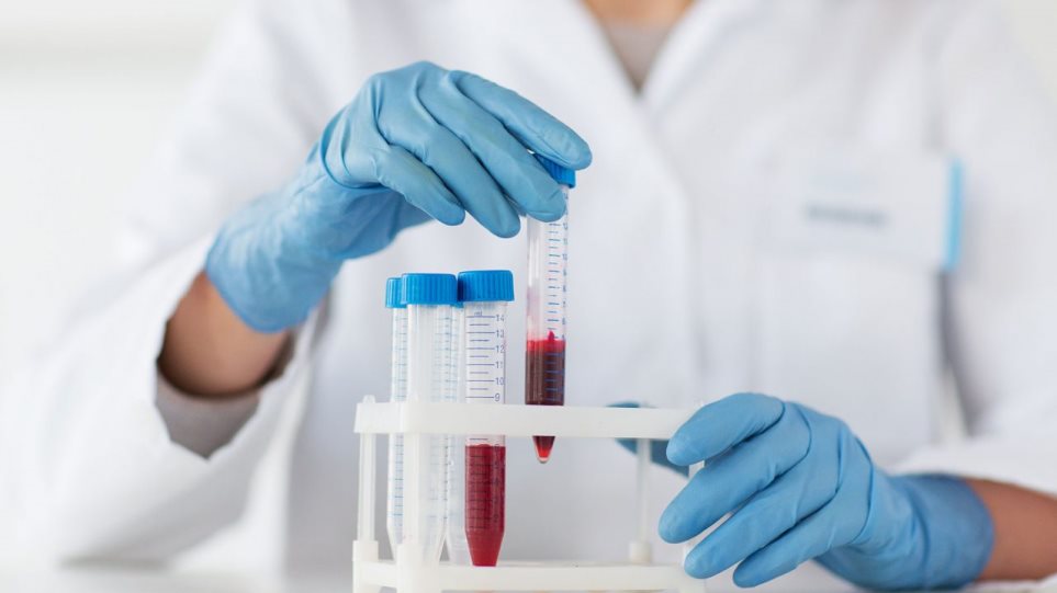 Ξεκινά η μεγαλύτερη αιματολογική εξέταση που θα ανιχνεύει 50 είδη καρκίνων