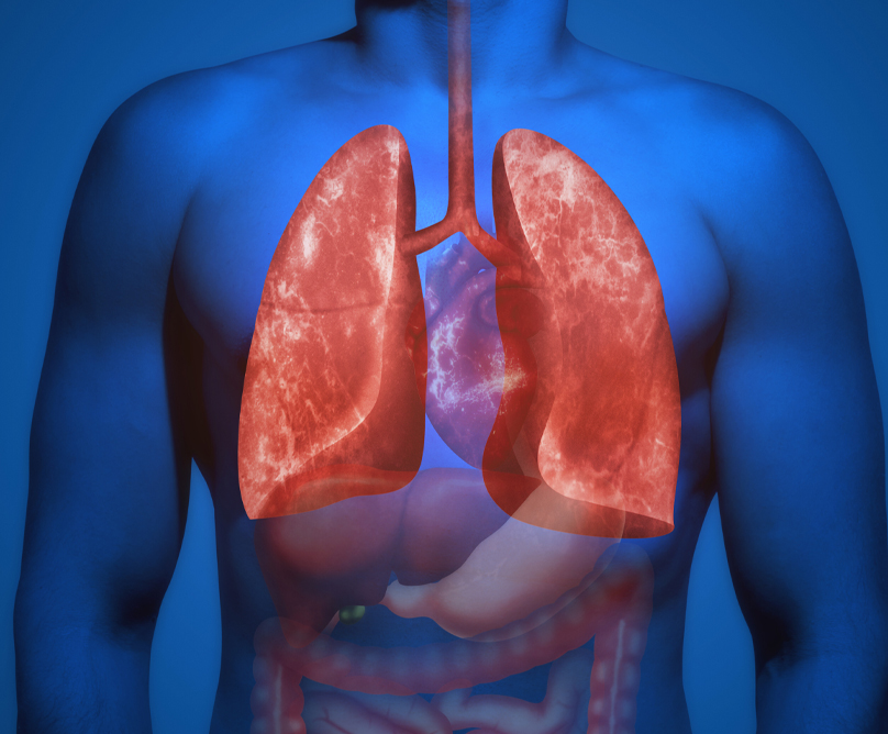 Διαθωρακικό υπερηχογράφημα πνευμόνων: Μια πολύτιμη διαγνωστική εξέταση χωρίς καθόλου ακτινοβολία