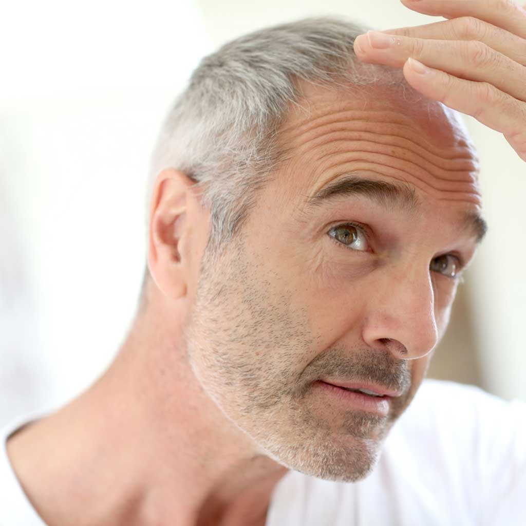 Μεταμόσχευση μαλλιών: Μπορεί να αλλάξει την κακή ψυχολογία;