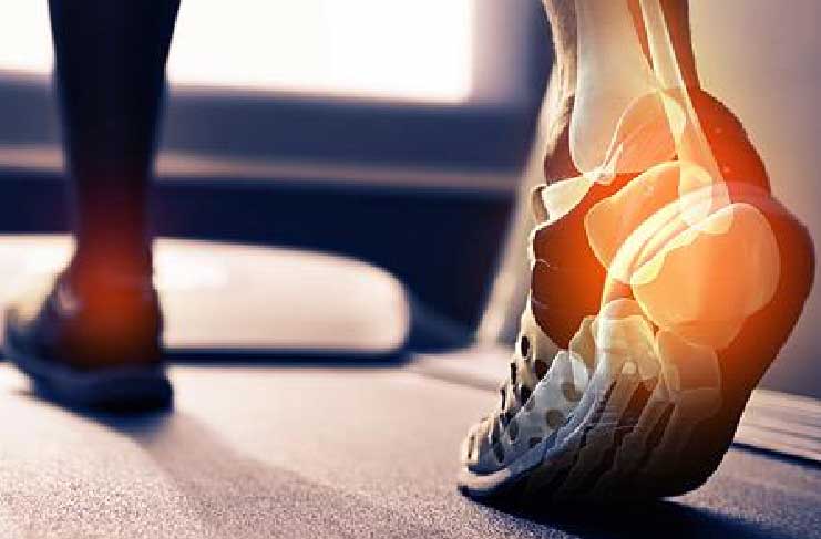 Το γρήγορο περπάτημα βοηθά στην αποκατάσταση του τραυματισμένου αχίλλειου τένοντα