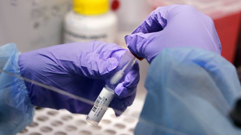 ΕΟΔΥ: 2.923 κρούσματα COVID-19 σε 25.357 rapid tests τη Δευτέρα