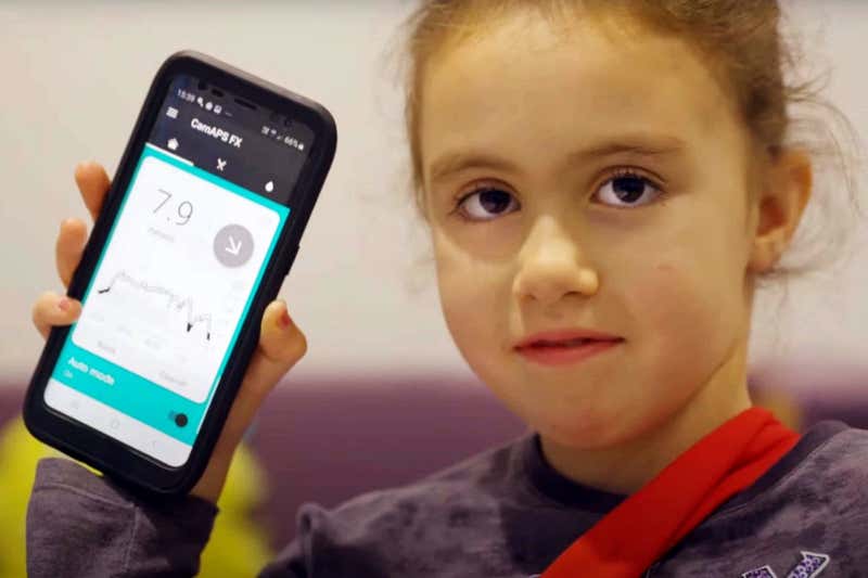 Το τεχνητό πάγκρεας «αλλάζει τη ζωή» για τα παιδιά με διαβήτη