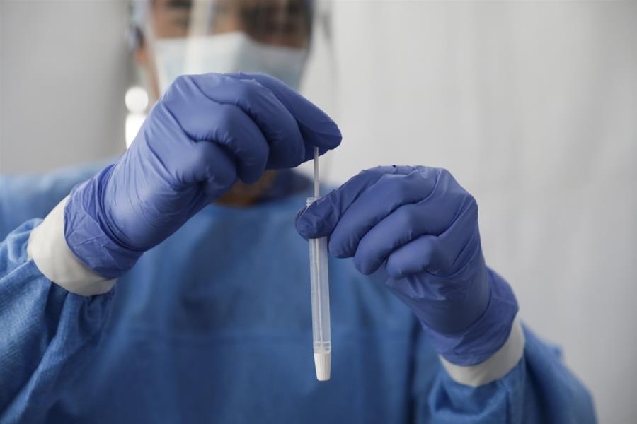 ΙΣΑ: Τα PCR να γίνονται με συνταγή γιατρού