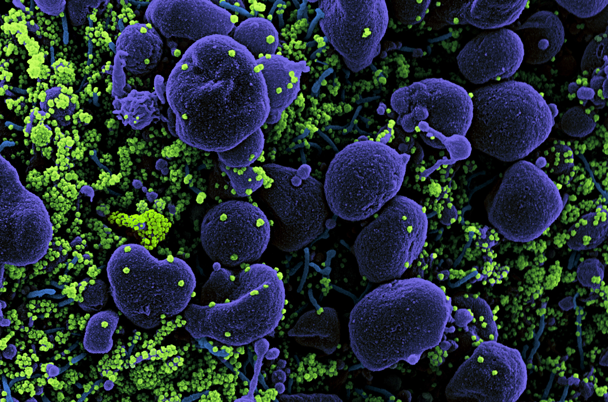 Αμερικανός βιολόγος αφήνει αιχμές για νέα πανδημία: «Κάνουν πειράματα με ιό που μπορεί να σκοτώσει εκατ. εάν απελευθερωθεί»