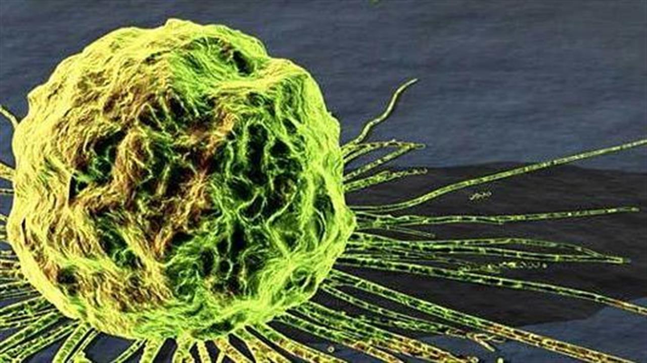 Γιατί κάποια καρκινικά κύτταρα επιζούν ακόμα και μετά από τη χημειοθεραπεία;