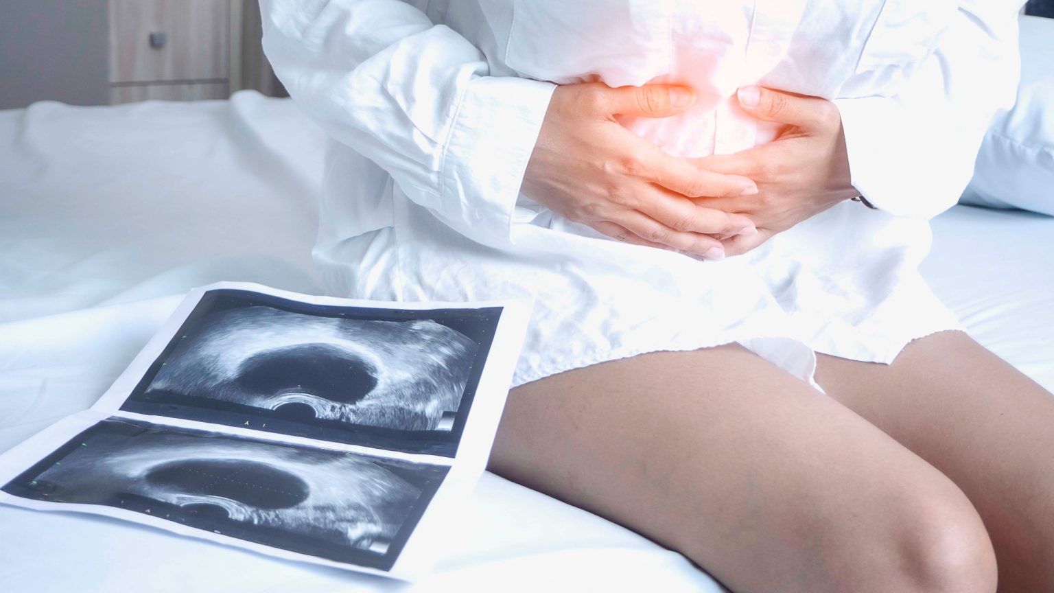 Πάρκινσον: Αυξημένος ο κίνδυνος εμφάνισης με την αφαίρεση ωοθηκών πριν την εμμηνόπαυση