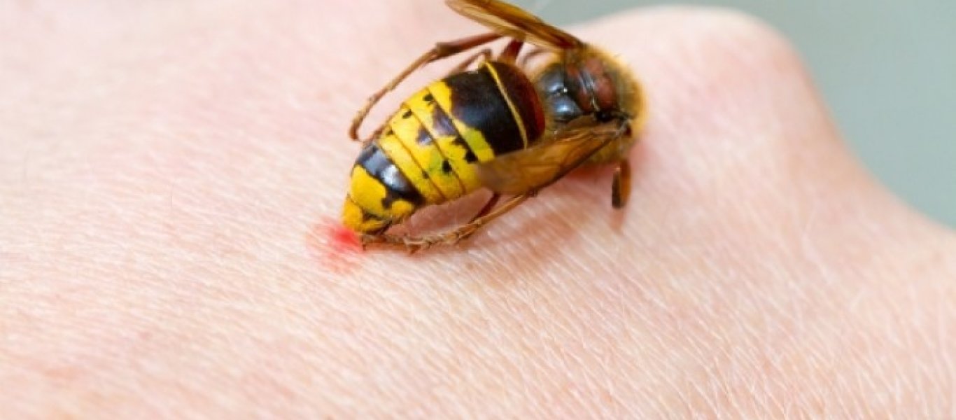 Τσίμπημα από μέλισσα, σφήκα ή άλλα έντομα: Δείτε πώς μπορείτε να τα αντιμετωπίσετε