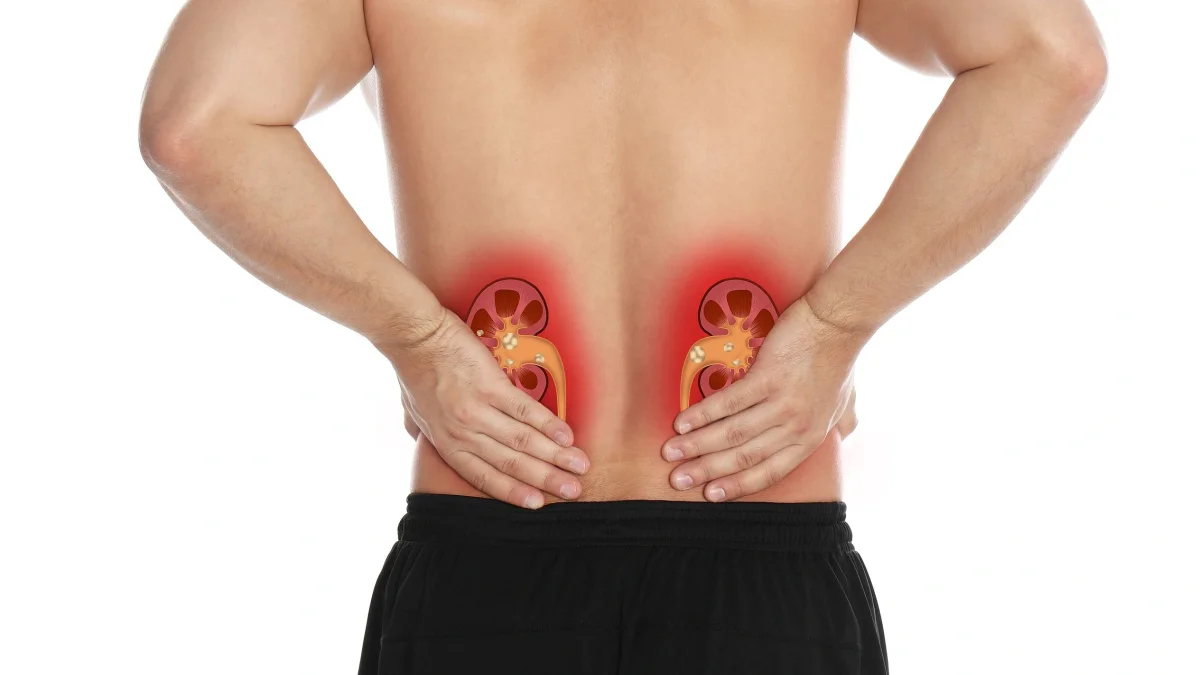 Μικρορομπότ θα ταξιδεύει μέσα στο σώμα όσων υποφέρουν από νεφρολιθίαση και θα σπάει τις πέτρες στα νεφρά!