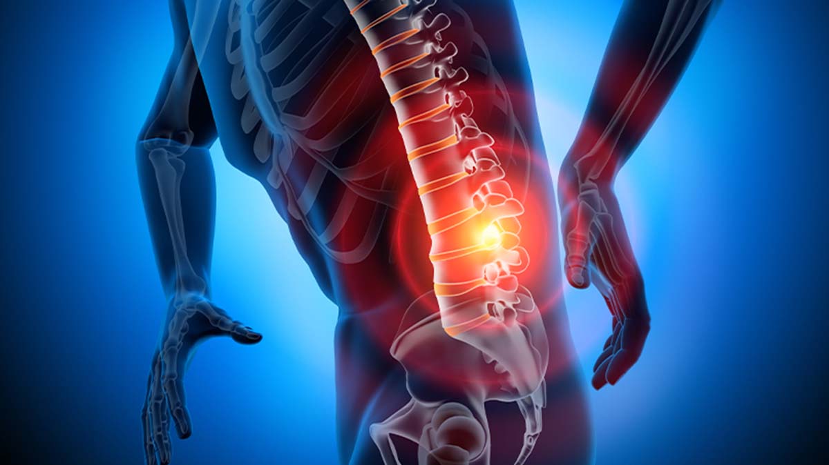 Πόνος στη μέση: Τα 5 συμπτώματα που δείχνουν ότι πρέπει να πάτε στον γιατρό
