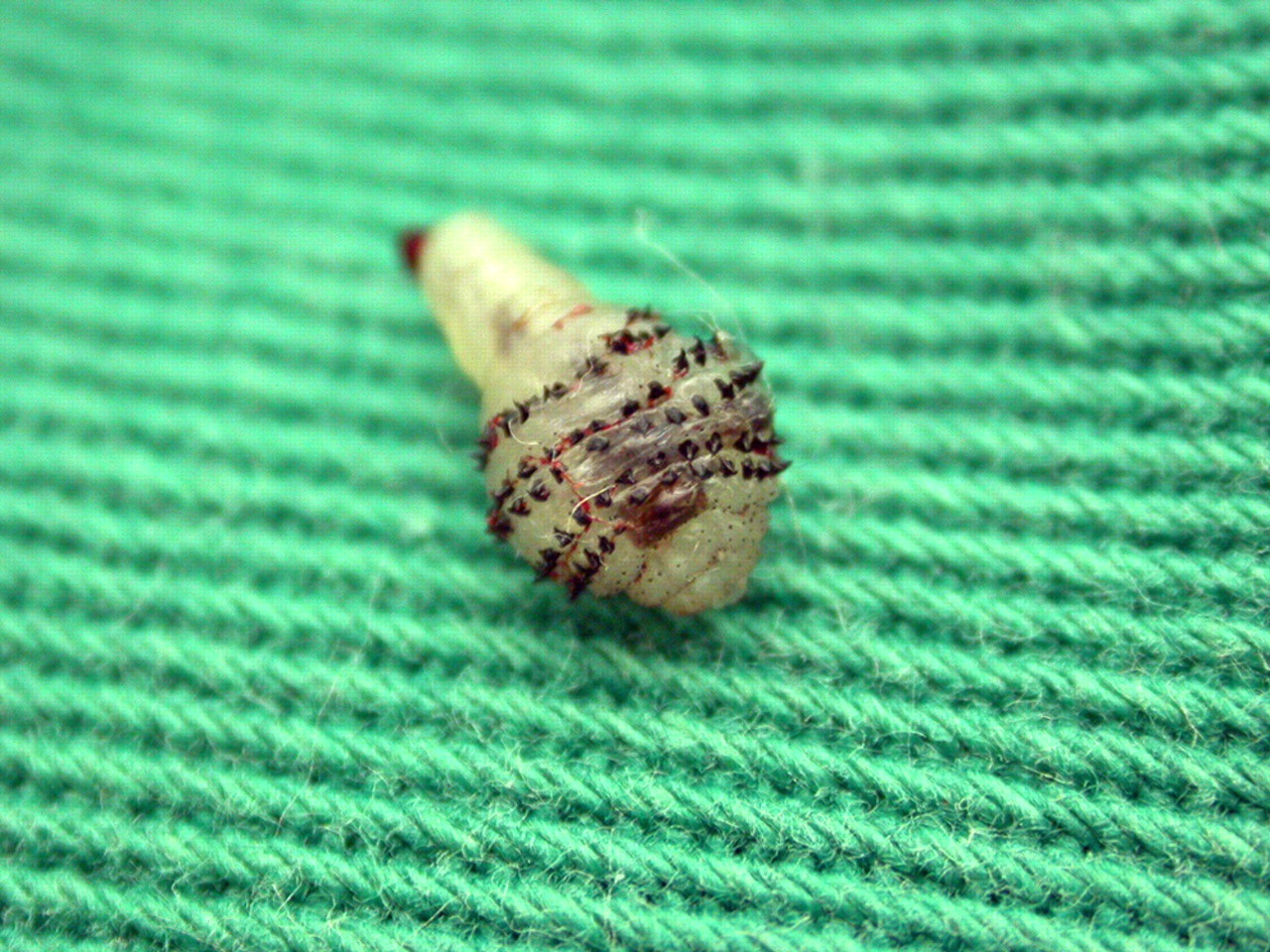 Απίστευτο: 58χρονη φτερνιζόταν και έβγαζε… «σκουλήκια» από την μύτη της! – Πώς μολύνθηκε σε ελληνικό νησί