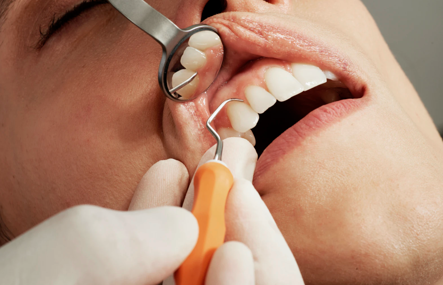 Ιαπωνία: Επιστήμονες ανέπτυξαν φάρμακο που μπορεί να επιτρέψει την αναγέννηση ανθρώπινων δοντιών!