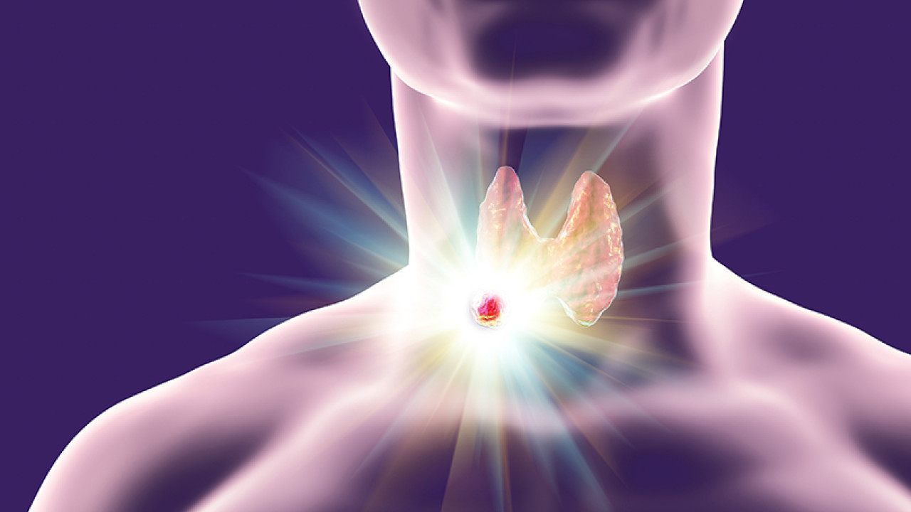 Όσα πρέπει να ξέρετε για τους όζους θυρεοειδούς: Τα συμπτώματα και οι πιθανές αιτίες