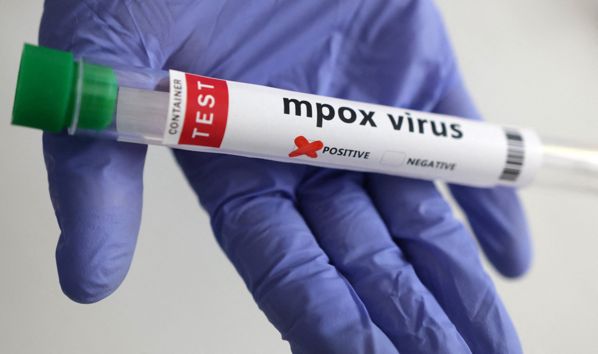 Κυβερνητικοί επιστήμονες μετέφεραν απενεργοποιημένο ιό mpox στις ΗΠΑ